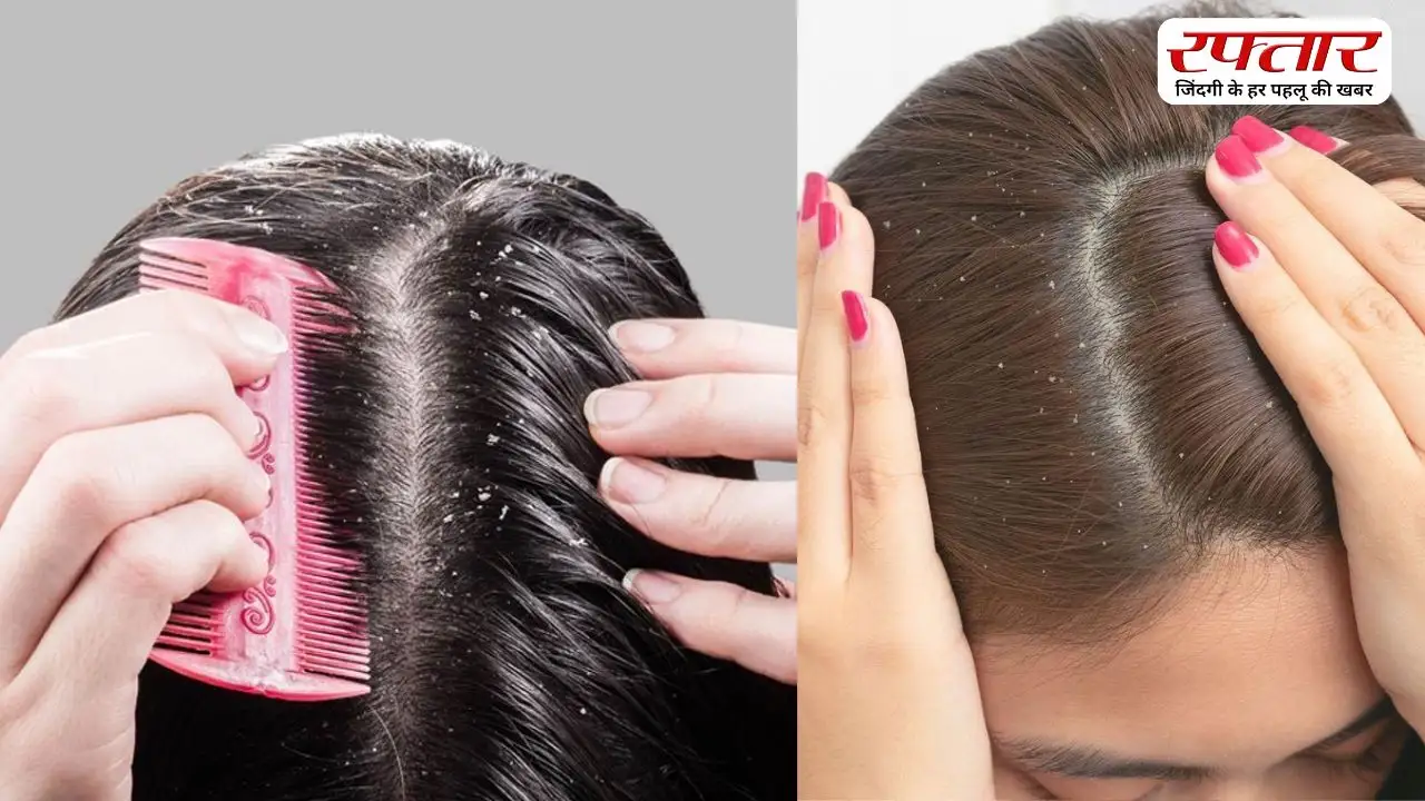 बार-बार हो रहा है डैंड्रफ, तो इन बातों को न करें नजरअंदाज