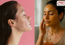 चेहरे की झाइयां से हो गईं हैं परेशान, तो घर पर ही करें ये उपाय