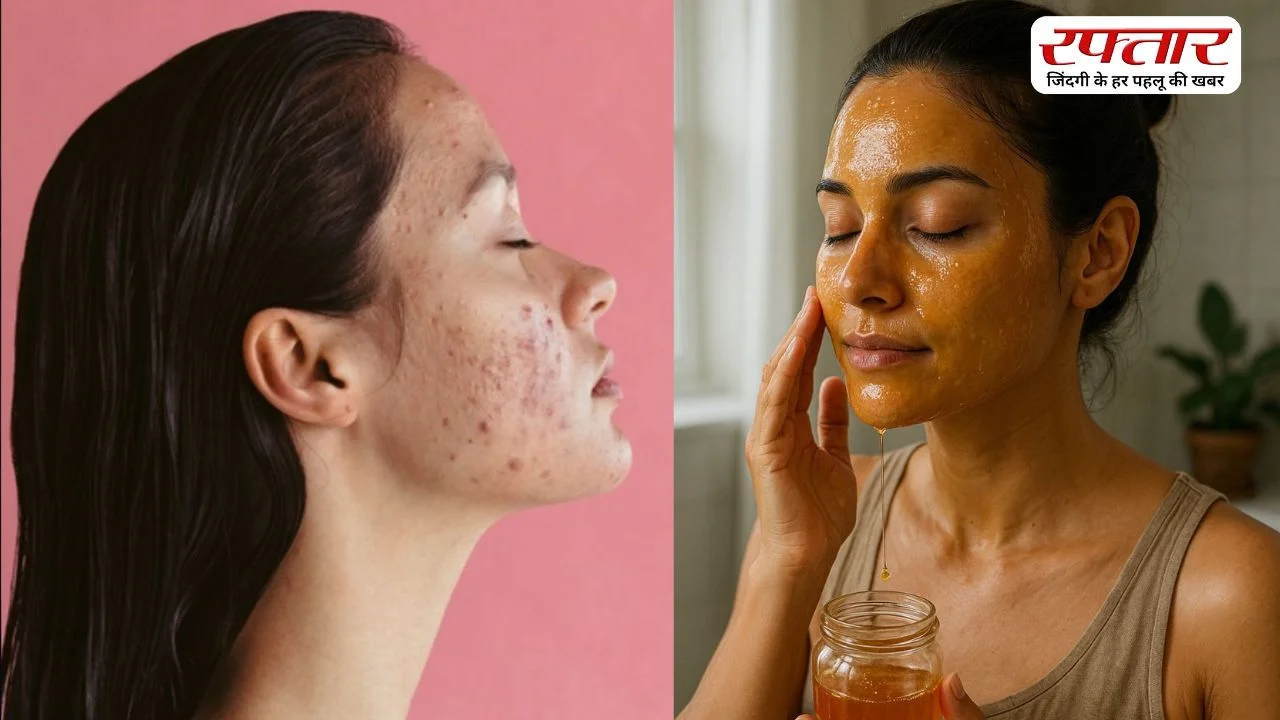 चेहरे की झाइयां से हो गईं हैं परेशान, तो घर पर ही करें ये उपाय